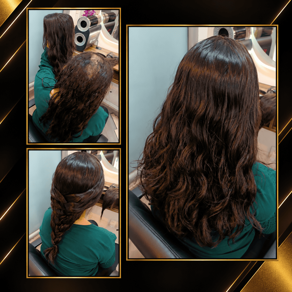 Pelucas para alopecia