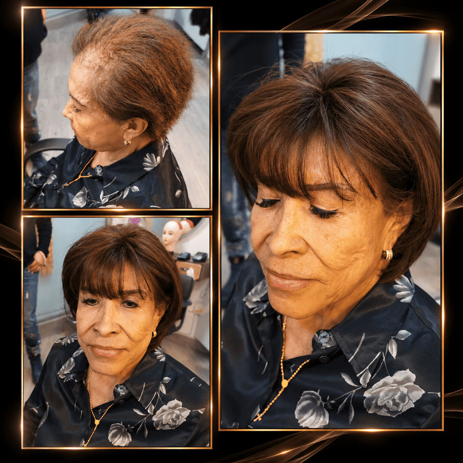 Pelucas para alopecia