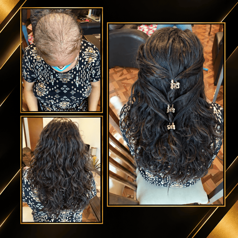 Pelucas de cabello natural y pelucas oncológicas
