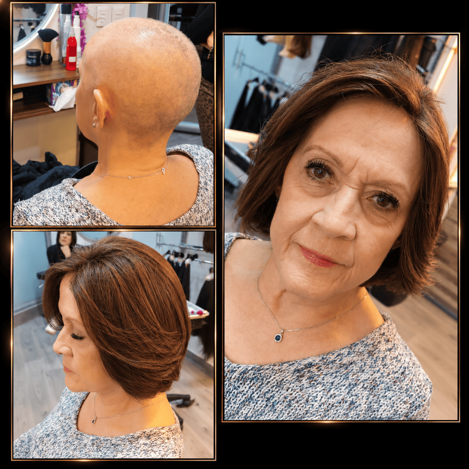 Pelucas de cabello natural y pelucas oncológicas