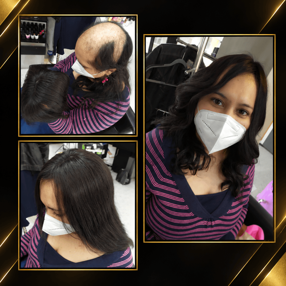 Topper clip para alopecia